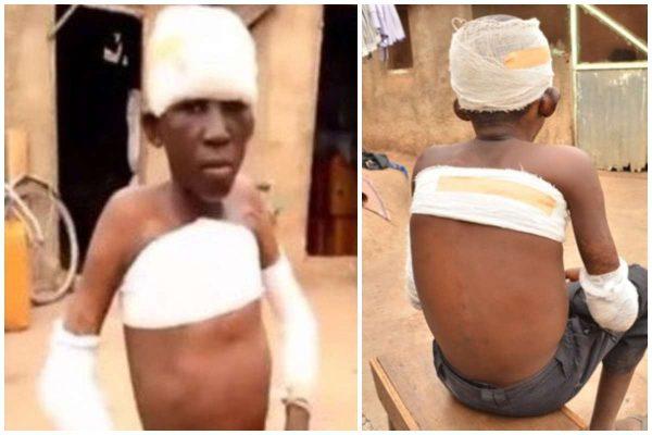 Absurd: Maxwell Ayinbisa (11) set ablaze for peeping a woman